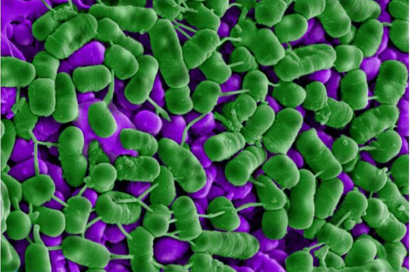 La bactérie Listeria (en vert) est détruite après contact avec Plantacyclin B21AG. Des gonflements verts visibles apparaissent sur de nombreuses cellules.
 Ils indiquent une destruction et une fuite du contenu cellulaire.